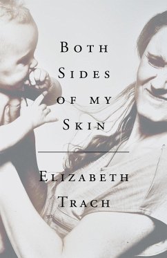 Both Sides of My Skin - Trach, Elizabeth