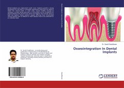 Osseointegration In Dental Implants