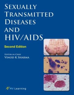 Sexually Transmitted Diseases and Hiv/AIDS - Sharma, Vinod K.