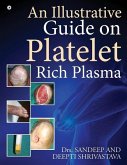 An Illustrative Guide on Platelet Rich Plasma