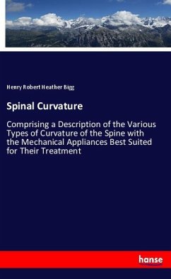 Spinal Curvature - Bigg, Henry Robert Heather