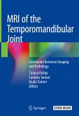 MRI of the Temporomandibular Joint (eBook, PDF)