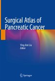 Surgical Atlas of Pancreatic Cancer (eBook, PDF)