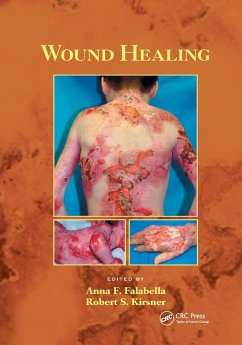 Wound Healing