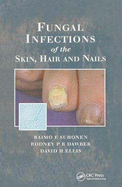 Fungal Infections of the Skin and Nails - Suhonen, Raimo E; Dawber, Rodney P R; Ellis, David H