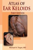 Atlas of Ear Keloids
