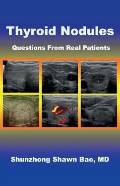 Thyroid Nodules: Questions From Real Patients - Bao, Shunzhong Shawn