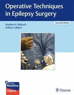 Operative Techniques in Epilepsy Surgery (eBook, PDF) - Baltuch, Gordon H.; Cukiert, Arthur Operative Techniques in Epilepsy Surgery (eBook, PDF) - Baltuch, Gordon H.; Cukiert, Arthur