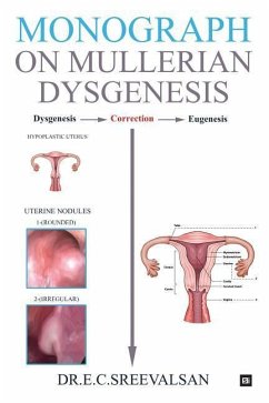 Monograph on Mullerian Dysgenesis - E. C. Sreevalsan