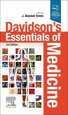 Davidson's Essentials of Medicine - Innes, J. Alastair (Consultant Physician, Respiratory Unit, Western