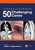 Thoracic Surgery: 50 Challenging cases (eBook, ePUB)