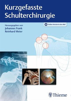 Kurzgefasste Schulterchirurgie (eBook, ePUB)