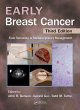 Early Breast Cancer (eBook, PDF) - Bild 1