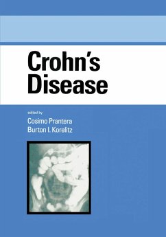 Crohn's Disease (eBook, PDF)