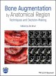 Bone Augmentation by Anatomical Region - Bild 1