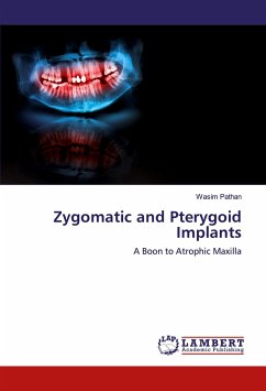 Zygomatic and Pterygoid Implants - Pathan, Wasim