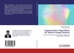 Segmentation Algorithms for Retinal Image Analysis - Naluguru, Udaya Kumar; Tirumala, Ramashri