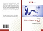 Inflammation et cancer du colon