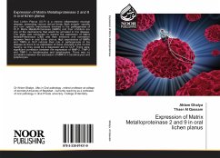 Expression of Matrix Metalloproteinase 2 and 9 in oral lichen planus - Ghalya, Ahlam;Al Qassam, Thaer