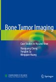 Bone Tumor Imaging (eBook, PDF)