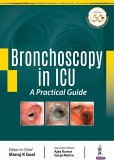 Bronchoscopy in ICU
