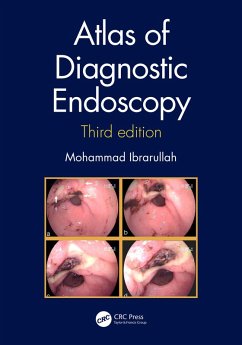 Atlas of Diagnostic Endoscopy, 3E (eBook, ePUB) - Ibrarullah, Mohammad