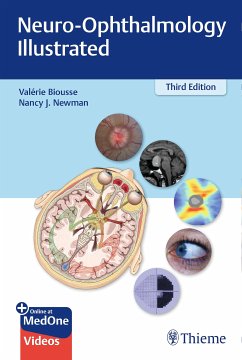 Neuro-Ophthalmology Illustrated (eBook, PDF) - Biousse, Valerie; Newman, Nancy