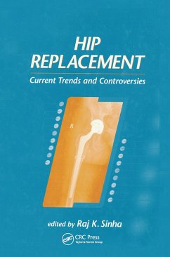 Hip Replacement - Sinha, Raj K