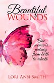 Beautiful Wounds (eBook, ePUB) Beautiful Wounds (eBook, ePUB)