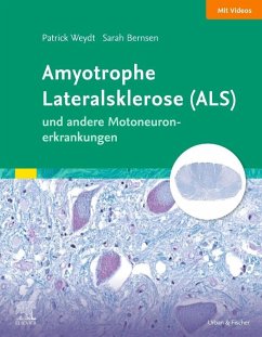 Amyotrophe Lateralsklerose (ALS) und andere Motoneuronerkrankungen - Weydt, Patrick;Bernsen, Sarah;Friese, Johannes