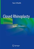 Closed Rhinoplasty (eBook, PDF)