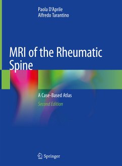 MRI of the Rheumatic Spine (eBook, PDF) - D'Aprile, Paola; Tarantino, Alfredo