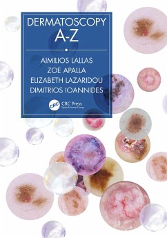 Dermatoscopy A-Z - Lallas, Aimilios; Apalla, Zoe; Lazaridou, Elizabeth