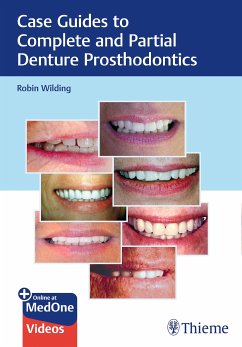 Case Guides to Complete and Partial Denture Prosthodontics (eBook, PDF) - Wilding, Robin