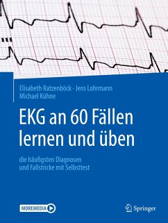 EKG an 60 Fällen lernen und üben - Ratzenböck, Elisabeth;Lohrmann, Jens;Kühne, Michael