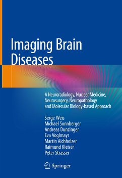 Imaging Brain Diseases (eBook, PDF) - Weis, Serge; Sonnberger, Michael; Dunzinger, Andreas; Voglmayr, Eva; Aichholzer, Martin; Kleiser, Raimund; Strasser, Peter