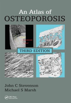 An Atlas of Osteoporosis - Stevenson, John C.; Marsh, Michael S.