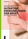 Gutartige Erkrankungen der Brust (eBook, PDF)
