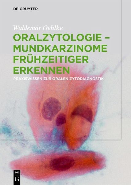 Oralzytologie - Mundkarzinome frühzeitiger erkennen (eBook, PDF) Oralzytologie - Mundkarzinome frühzeitiger erkennen (eBook, PDF)