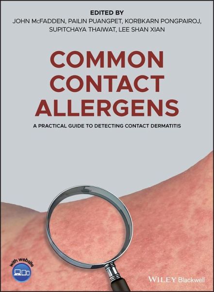 Common Contact Allergens (eBook, PDF)