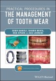 Practical Procedures in the Management of Tooth Wear (eBook, PDF)
