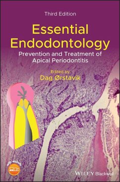 Essential Endodontology (eBook, ePUB)