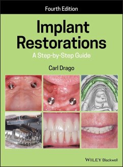 Cover Implant Restorations (eBook, PDF)