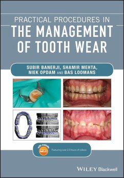 Practical Procedures in the Management of Tooth Wear (eBook, ePUB) - Banerji, Subir; Mehta, Shamir B.; Opdam, Niek; Loomans, Bas