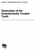 Restoration of the Endodontically Treated Tooth (eBook, ePUB)