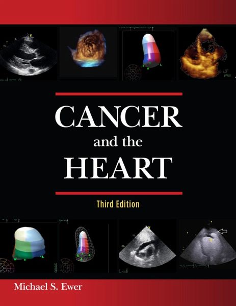 Cancer and the Heart (eBook, ePUB) Cancer and the Heart (eBook, ePUB)