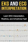 EKG and ECG Interpretation