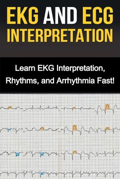 EKG and ECG Interpretation - Stone, Alyssa
