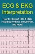 ECG & EKG Interpretation - Bild 1