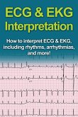 ECG & EKG Interpretation